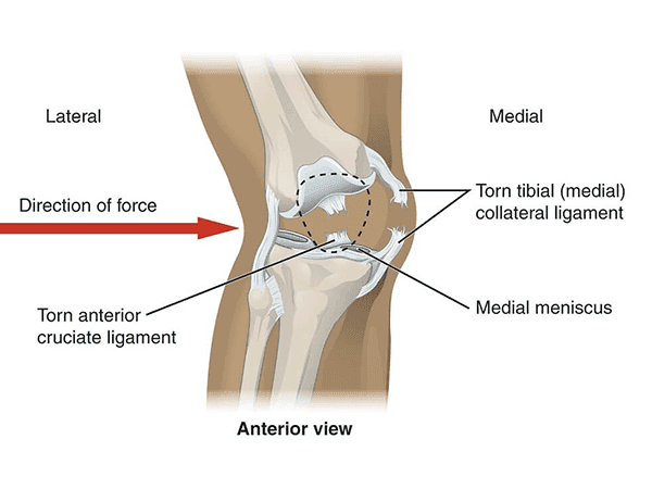 ACL Reconstruction Procedure