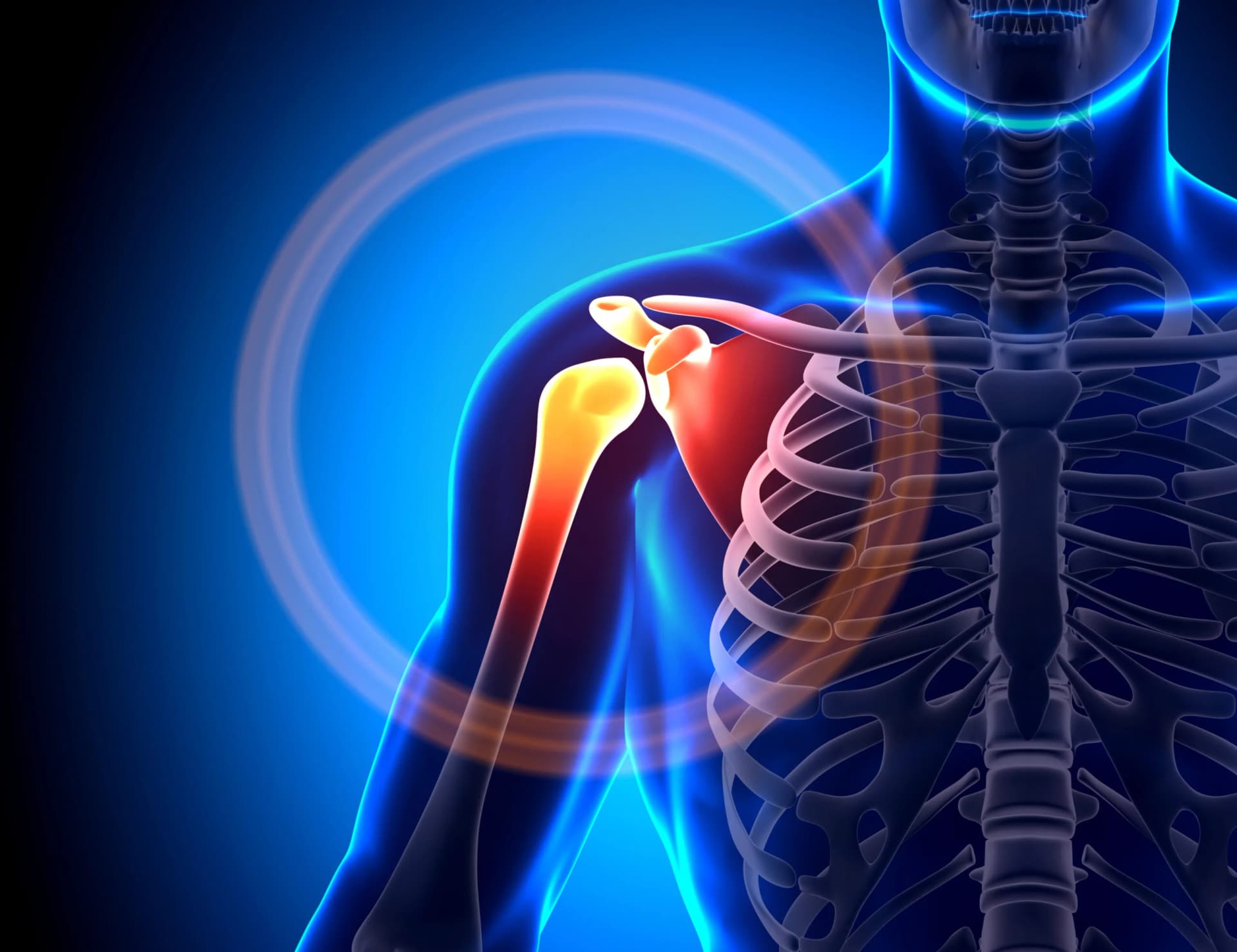 Injuries Around Shoulder Treatment