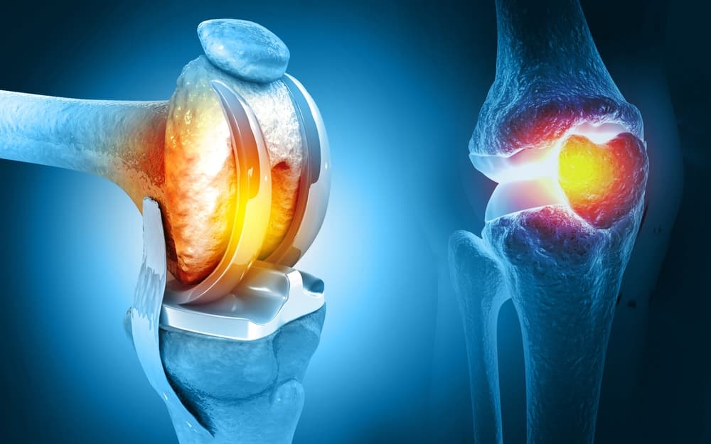 Joint Replacement Surgery in Ajmer - Dr. Abhishek Saxena | Knee, Hip & Shoulder Replacement