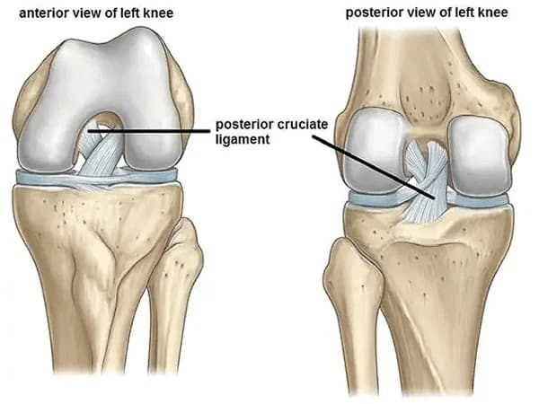 PCL Injury Procedure