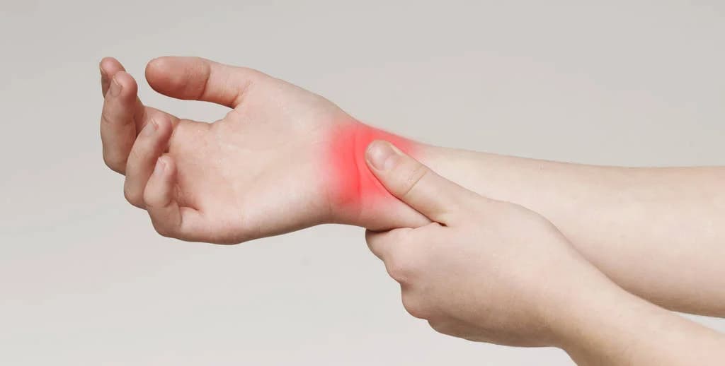 Sprains