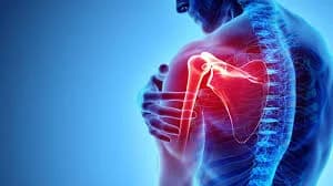 Shoulder Replacement Procedure